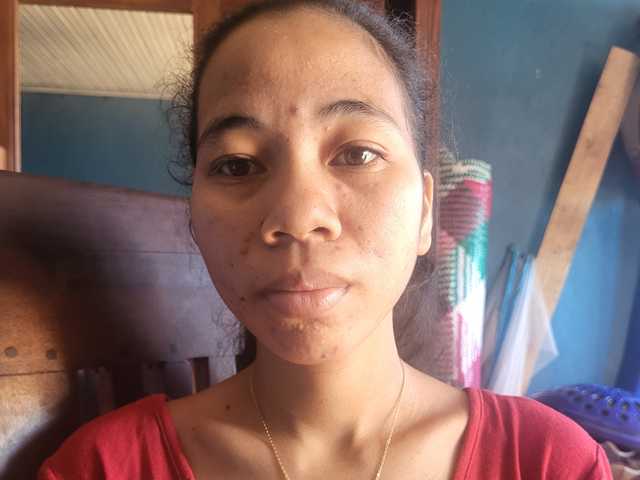 Aluciah1a