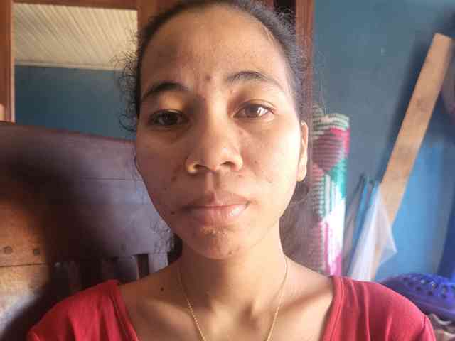 Aluciah1a