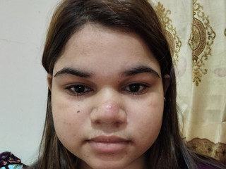 My Photos