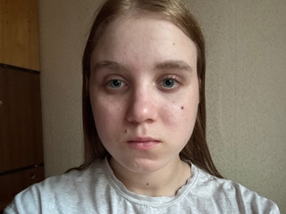 My Photos