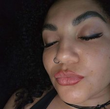 Morfea-69