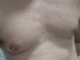 My Photos