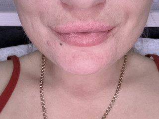 Lips