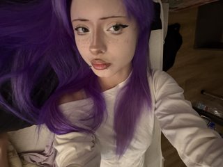 hipertoniya1