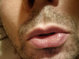 My Photos