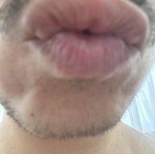 superass6