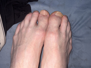 Feet