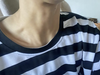 My Image