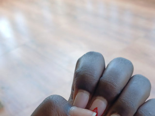 My Photos