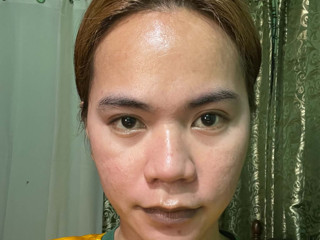 My Photos