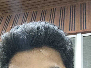 My Photos