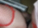 Anal
