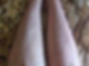 Hairy legs