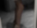 Legs