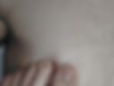The foot pinches the nipple