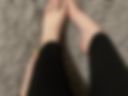 Legs