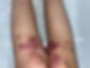 legs