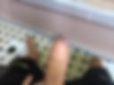 Dick