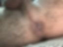 anal🤭