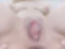 18+