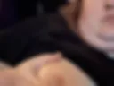 Right nipple