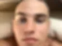 no hair no