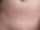 Penis