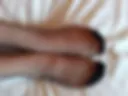 New photo of the leg and