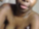 Xn