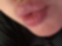 Lips/tongue