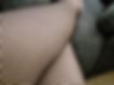 legs and mesh