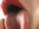 MILFEVROT