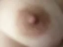 Papilla