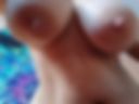 Breast