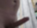 Penis