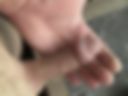 Anal