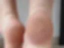 Dirty feet