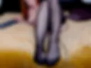 Legs
