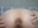 4 Cancer close-up