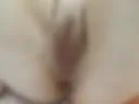 anal