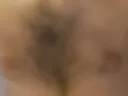 Breasts and nipples