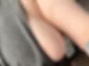 Side boob