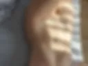 17 Sun glare on skin