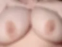 Breast