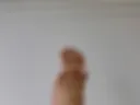 white toe nails