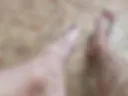 Legs and feet