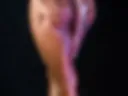 Hot1