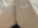 Legs