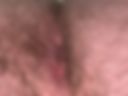 Hairy Asshole
