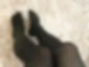 Legs